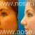 الأنف جراحة التجميل، للدكتور محسن نراقی