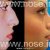الأنف جراحة التجميل، للدكتور محسن نراقی