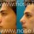 الأنف جراحة التجميل، للدكتور محسن نراقی