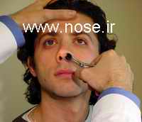nose2