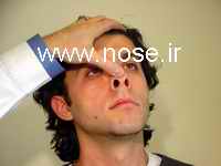 nose3
