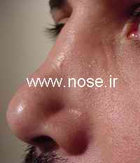 nose7