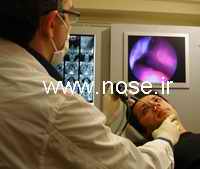 1 Nose Endoscopy